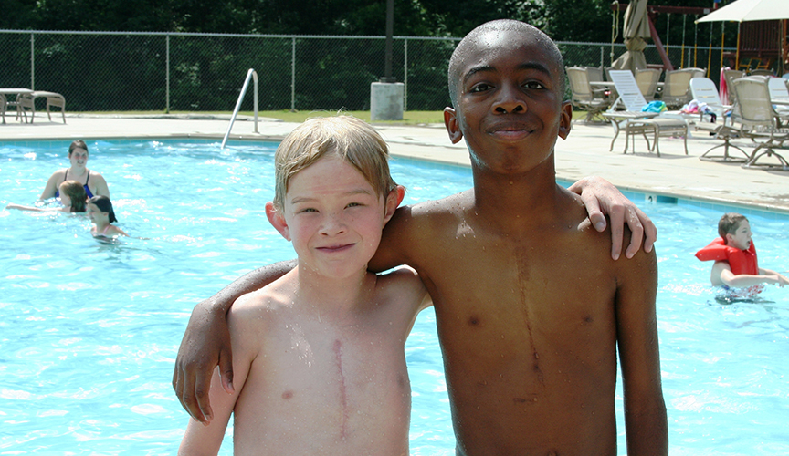 Two boys swimming at Cardiac Kids Camp.